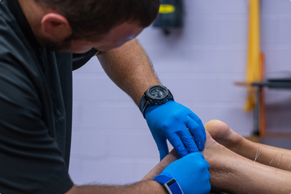dry-needling-service dry needling service